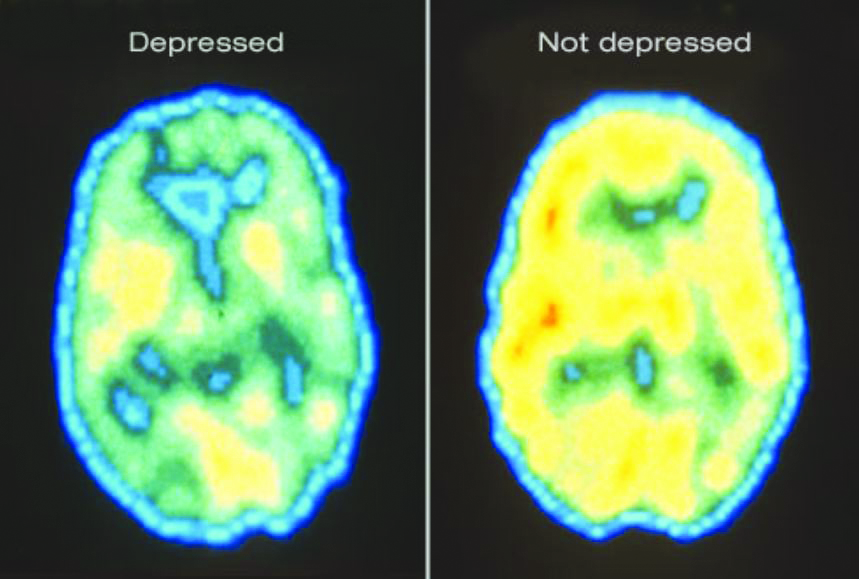 FOUR HORMONES DETERMINE HUMAN HAPPINESS!