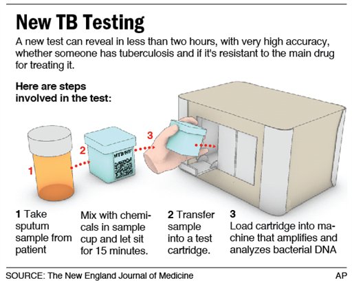 MANY TESTS TO CONFIRM TUBERCULOSIS!