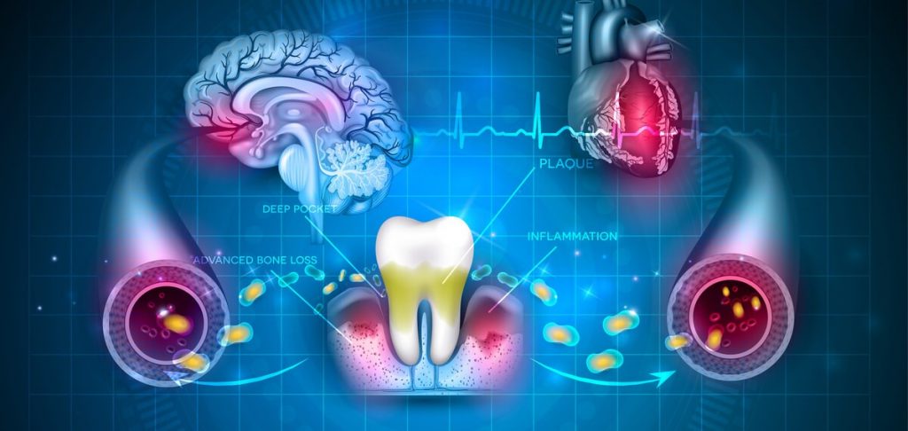 THE MOUTH-BODY CONNECTION!
