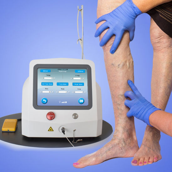GMC   GETS   LASER  MACHINE FOR VARICOSE VEINS… By Pankajbala R Patel