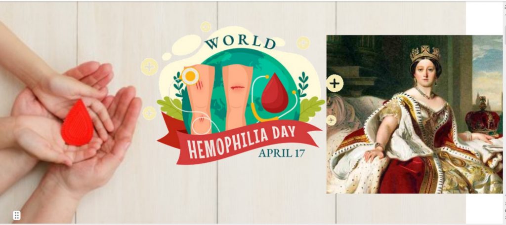 HEMOPHILIA NOT JUST A ROYAL ISSUE
