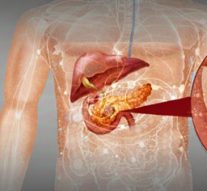 Pancreatic Cancer: The Rise of the Silent Killer