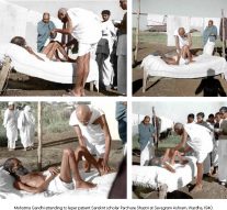 LEPROSY IS CURABLE: THE REAL CHALLENGE IS STIGMA! By Dr Amit Dias